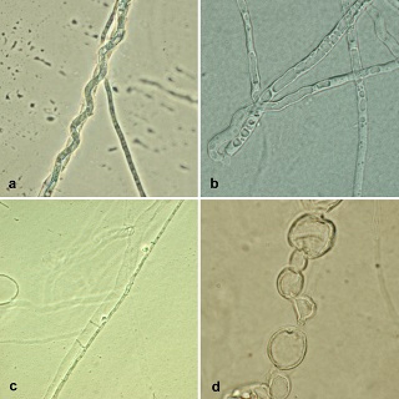 Biobeheeragente vir stampatogene Figuur 2