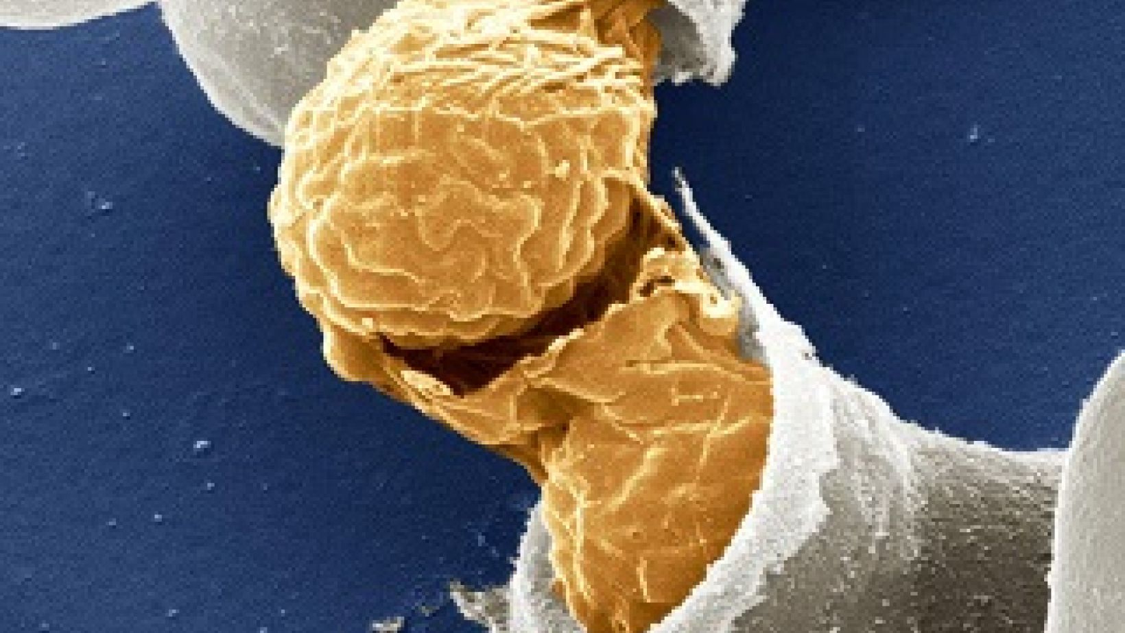 Impact of yeast strains on concentration of oenologically relevant proteins Flickr