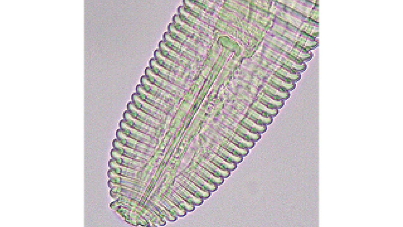 Ringaalwurm fig2