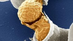 Impact of yeast strains on concentration of oenologically relevant proteins Flickr